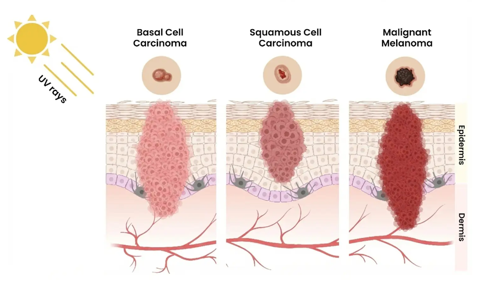 skin lesions